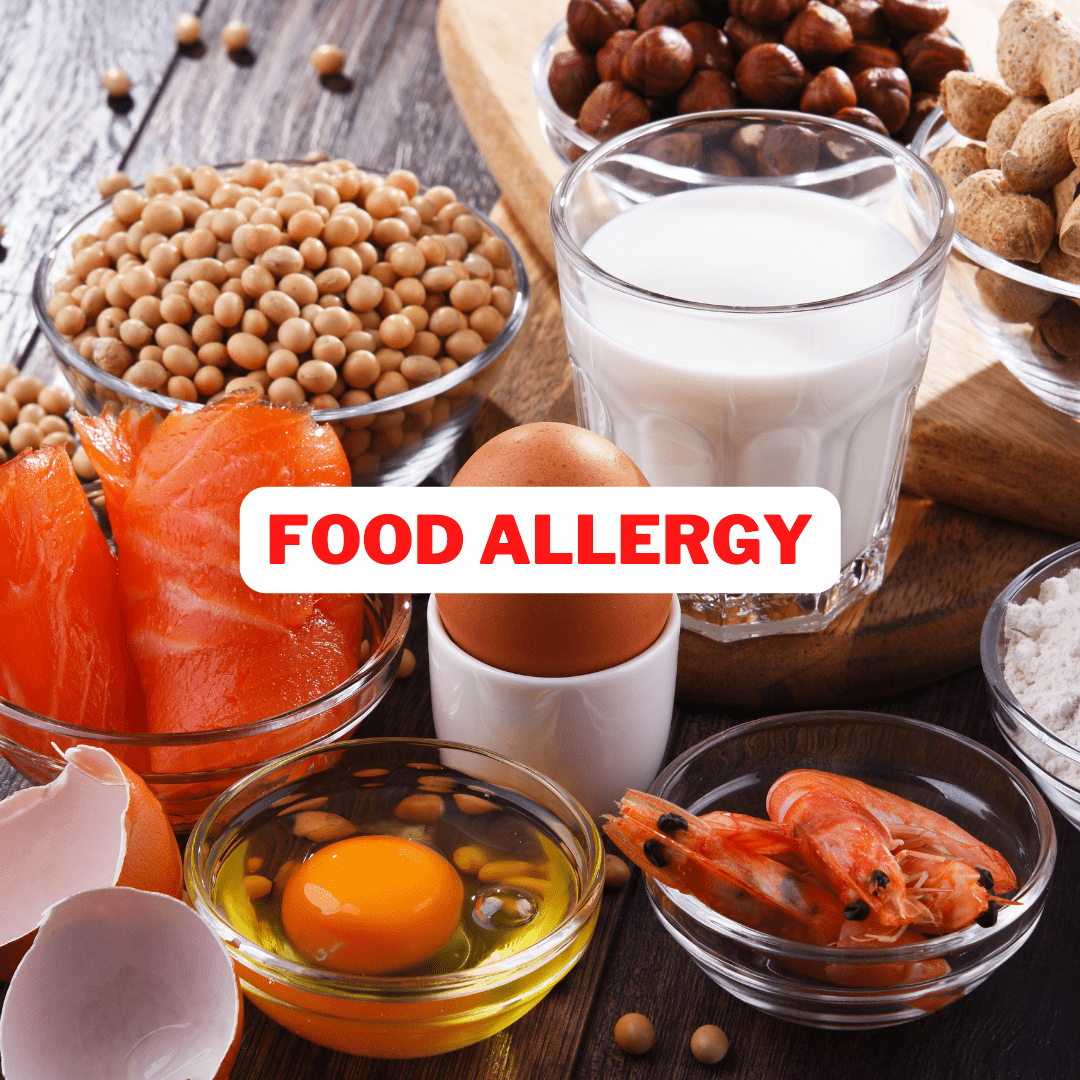 Dietary Requirements And Allergy Management In Your Early Years Setting 